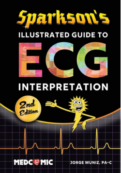 Sparkson's Illustrated Guide to ECG Interpretation, 2nd Edition