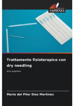 Trattamento fisioterapico con dry needling