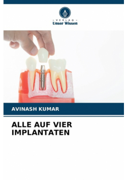 Alle Auf Vier Implantaten