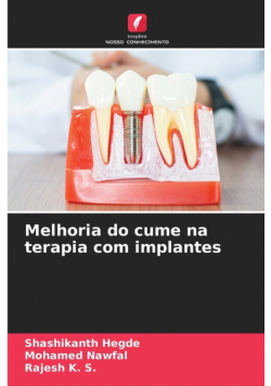 Melhoria do cume na terapia com implantes