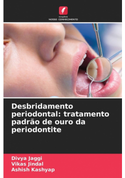 Desbridamento periodontal
