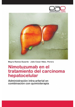 Nimotuzumab en el tratamiento del carcinoma hepatocelular