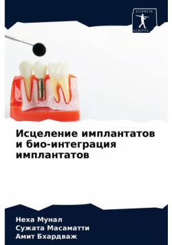 Исцеление имплантатов и био-интеграция имплантатов