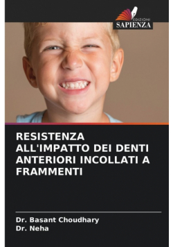 Resistenza All'impatto Dei Denti Anteriori Incollati A Frammenti