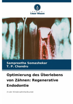 Optimierung des Überlebens von Zähnen