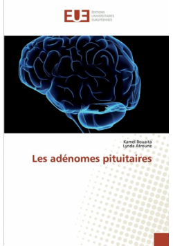 Les adénomes pituitaires