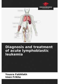 Diagnosis and treatment of acute lymphoblastic leukemia