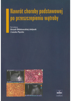 Nawrót choroby podstawowej po przeszczepieniu wątroby