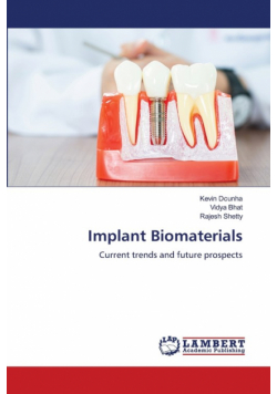 Implant Biomaterials