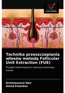 Technika przeszczepiania włosów metodą Follicular Unit Extraction (FUE)