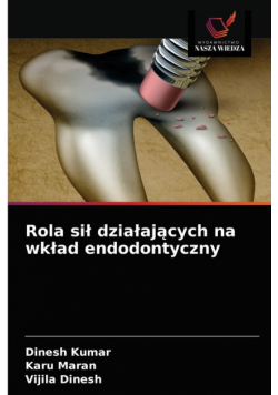 Rola sił działających na wkład endodontyczny