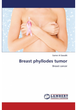 Breast phyllodes tumor