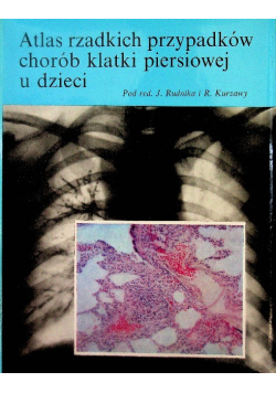 Atlas rzadkich przypadków chorób klatki piersiowej u dzieci
