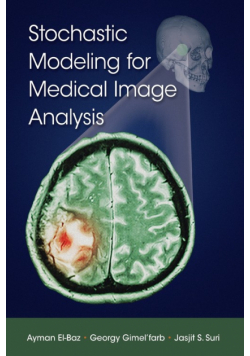 Stochastic Modeling for Medical Image Analysis