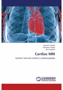 Cardiac MRI