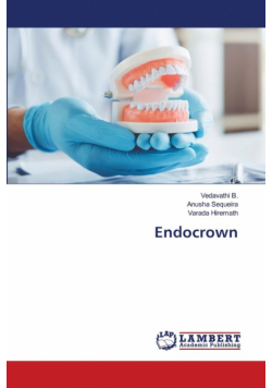 Endocrown