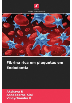 Fibrina rica em plaquetas em Endodontia