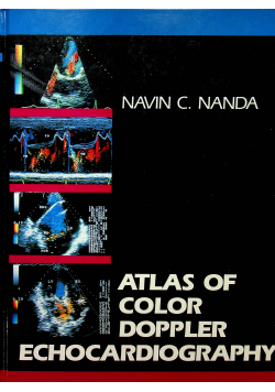 Atlas of color doppler echocardiography