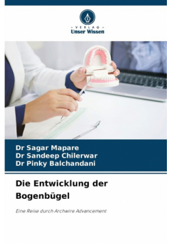 Die Entwicklung der Bogenbügel