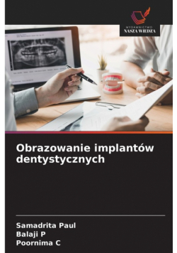 Obrazowanie implantów dentystycznych