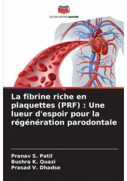 La fibrine riche en plaquettes (PRF)