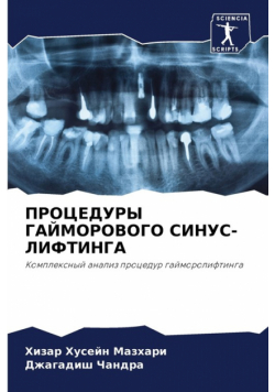 ПРОЦЕДУРЫ ГАЙМОРОВОГО СИНУС-ЛИФТИНГА