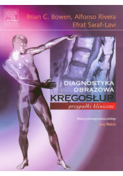 Kręgosłup: Przypadki kliniczne