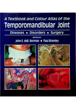 A textbook and colour atlas of the Temporomandibular Joint