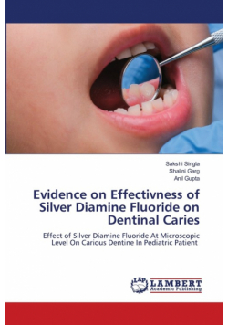 Evidence on Effectivness of Silver Diamine Fluoride on Dentinal Caries