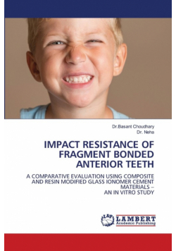 Impact Resistance Of Fragment Bonded Anterior Teeth