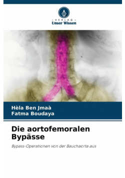 Die aortofemoralen Bypässe