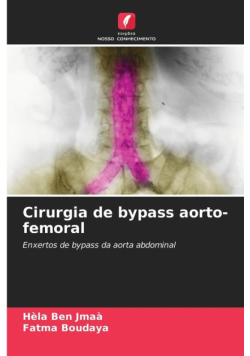 Cirurgia de bypass aorto-femoral