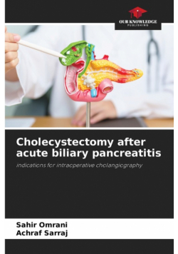 Cholecystectomy after acute biliary pancreatitis