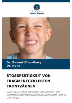 Stossfestigkeit Von Fragmentgeklebten Frontzähnen