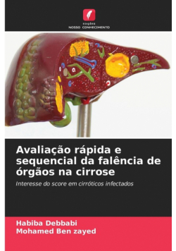 Avaliação rápida e sequencial da falência de órgãos na cirrose