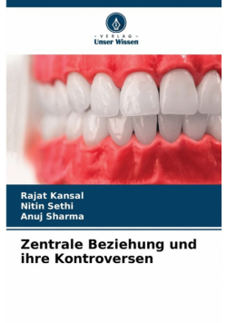 Zentrale Beziehung und ihre Kontroversen