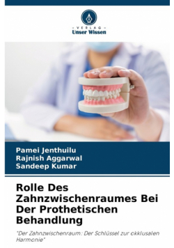Rolle Des Zahnzwischenraumes Bei Der Prothetischen Behandlung