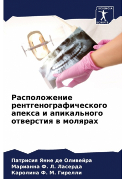 Расположение рентгенографического апекса и апикального отверстия в молярах