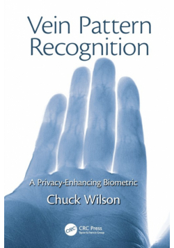 Vein Pattern Recognition