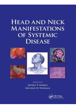 Head and Neck Manifestations of Systemic Disease