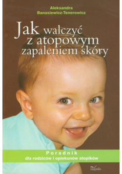 Jak walczyć z atopowym zapaleniem skóry