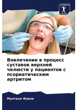 Вовлечение в процесс суставов верхней челюсти у пациентов с псориатическим артритом