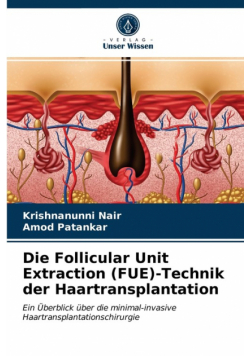 Die Follicular Unit Extraction (FUE)-Technik der Haartransplantation