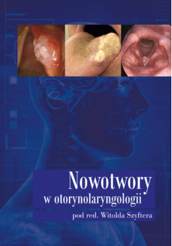Nowotwory w otorynolaryngologii
