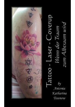 Tattoo - Laser - Cover Up