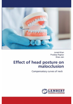 Effect of head posture on malocclusion