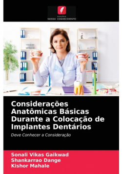 Considerações Anatômicas Básicas Durante a Colocação de Implantes Dentários