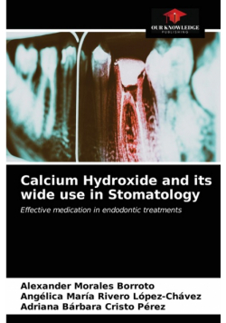 Calcium Hydroxide and its wide use in Stomatology