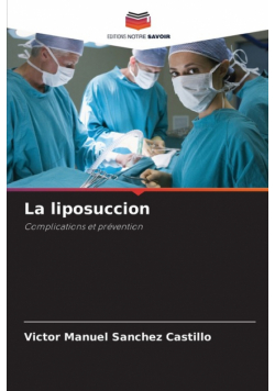 La liposuccion