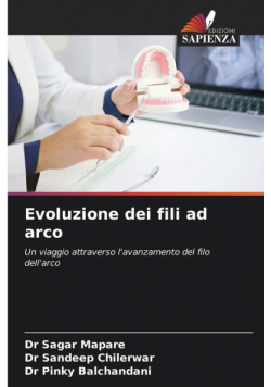 Evoluzione dei fili ad arco